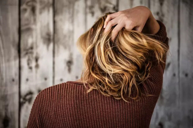 Dealing with hair loss? Here’s why you shouldn’t be embarrassed